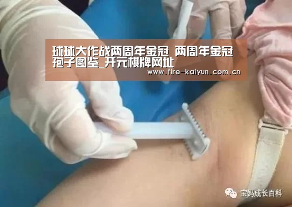 球球大作战两周年金冠 两周年金冠孢子图鉴_开元棋牌网址(图2) 开元